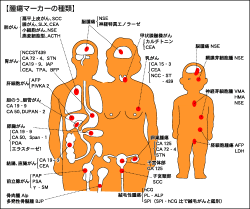 がんの腫瘍マーカー 時事用語事典 情報 知識 オピニオン Imidas イミダス